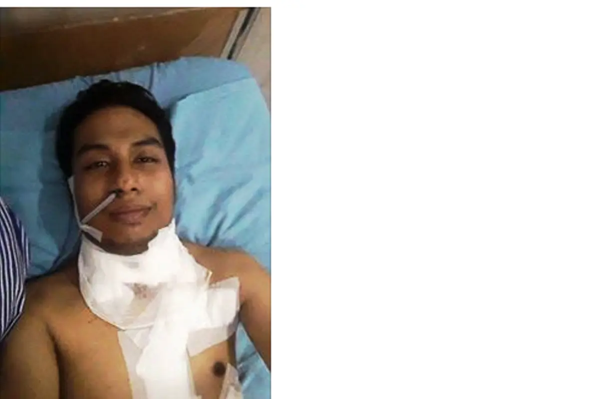 Terkena Kanker Pita Suara, Ini yang Terjadi Pada Robby