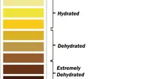 Status hidrasi berdasarkan warna urine.