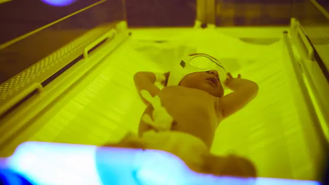 Penyebab Bayi Kuning