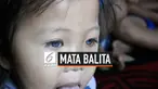 Amelia Anggraeni, balita perempuan berusia 2 tahun 5 bulan memiliki mata biru. Bahkan terkadang bola matanya dapat berubah keabu-abuan, cokelat hingga hitam. Fenomena ini menjadi perhatian seorang dokter mata rumah sakit
di Bandung.