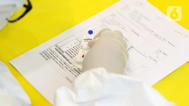 Proses Rapid Test COVID-19
