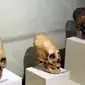 Ilustrasi Kepala Kerucut. (Sumber: Paracas Skulls Ica Museum via Wikimedia Commons/Public Domain)