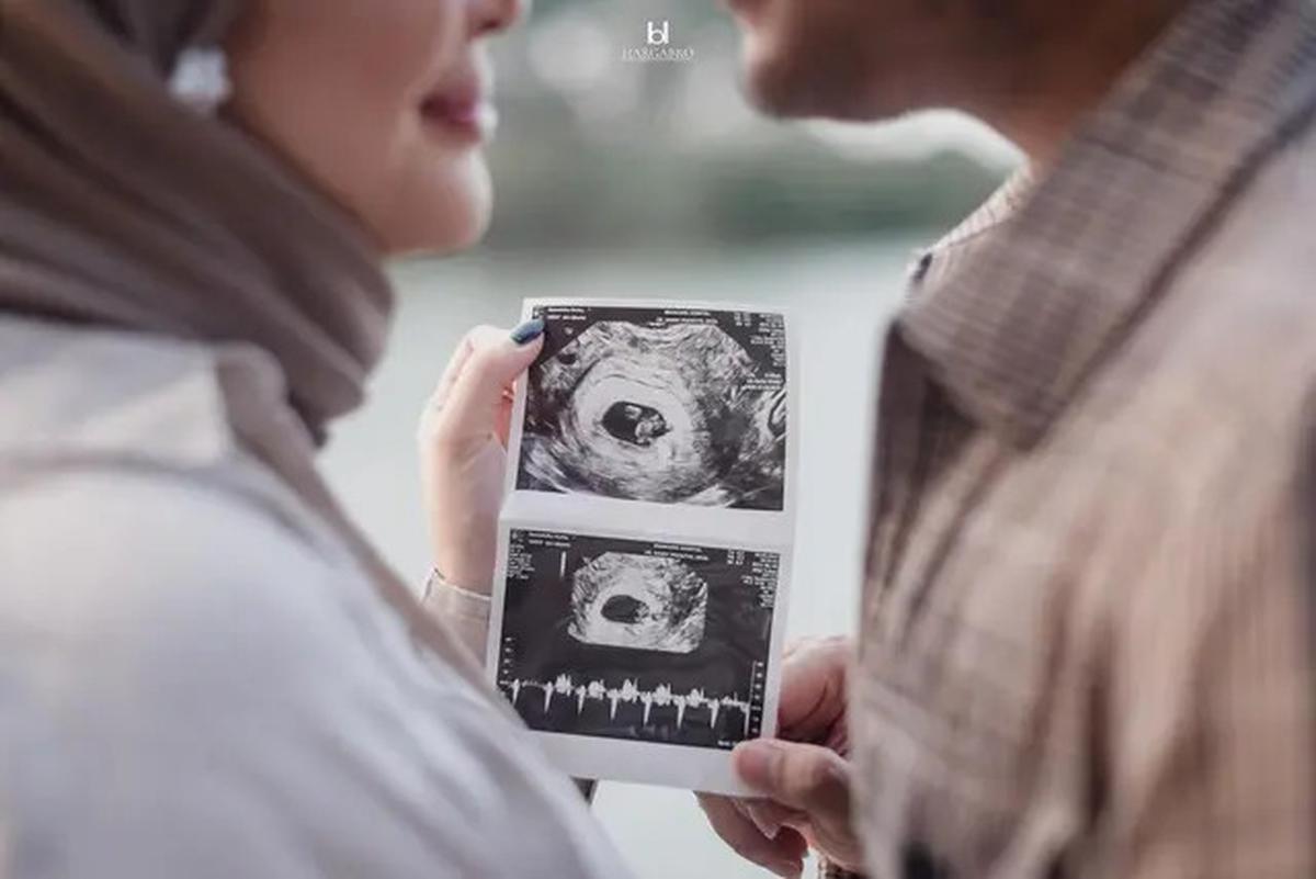 7 Potret Kesha Ratuliu Umumkan Hamil Anak Ketiga, KB IUD Bermasalah