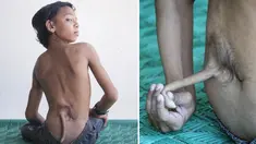 -