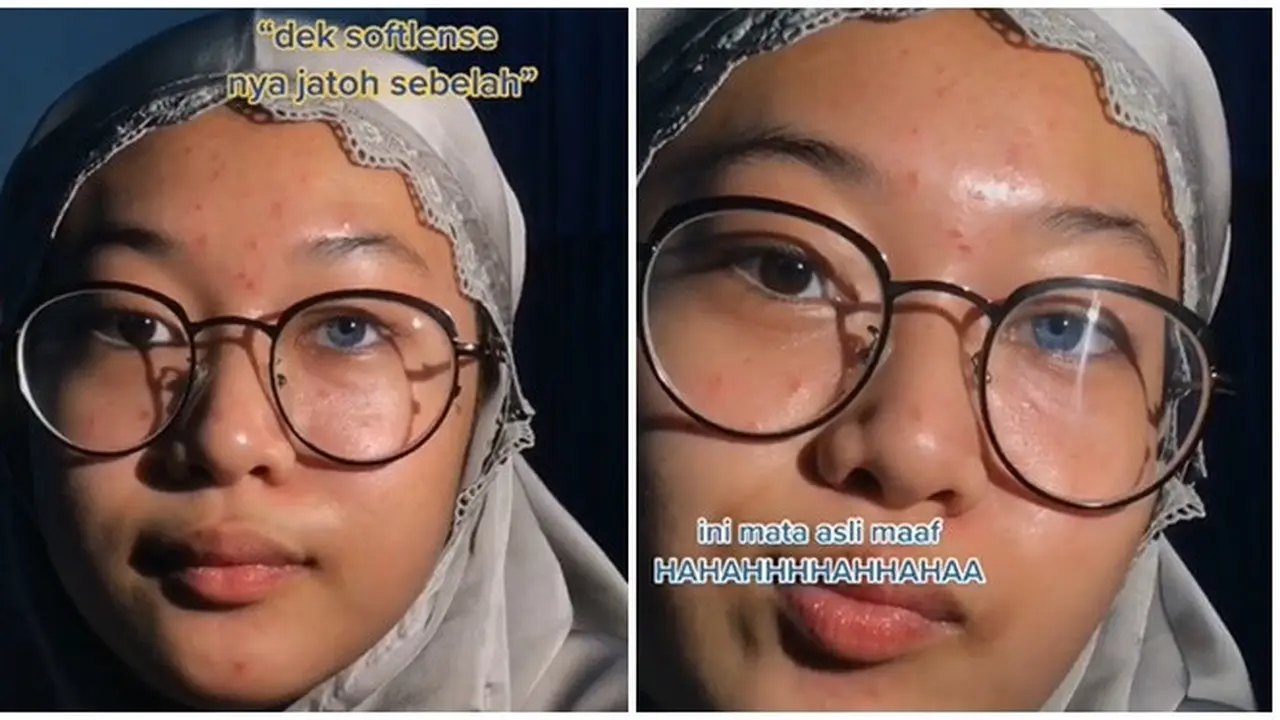 Sering Dikira Pakai Lensa Kontak, Warna Iris Mata Wanita Ini Curi Perhatian