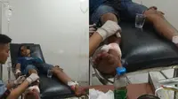 Dibacok Tetangga, Pria di Lampung Alami Luka Sekujur Tubuh
