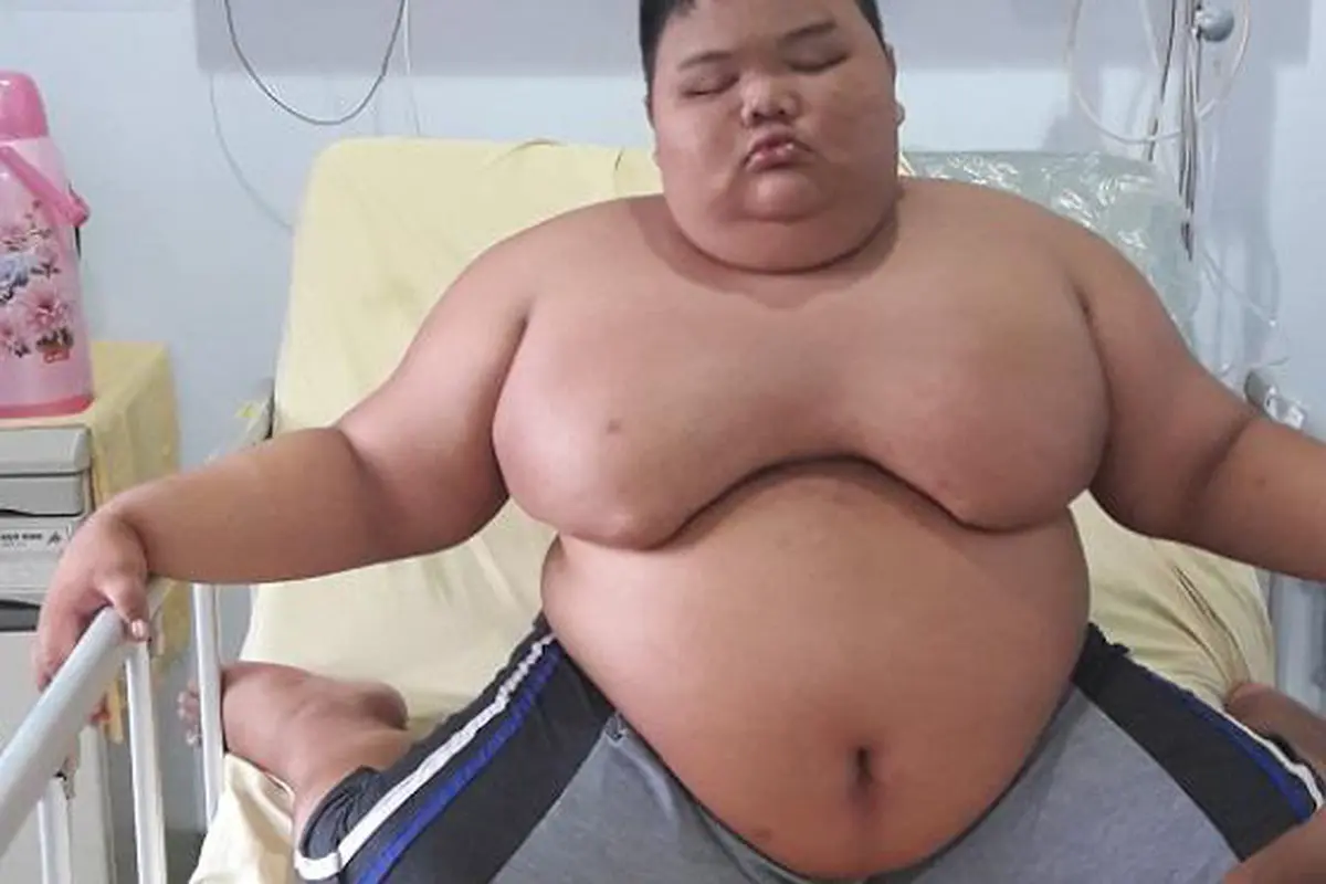 Top 3: Meski Koma, Rizki Bocah Obesitas Merespon Suara Ibunda