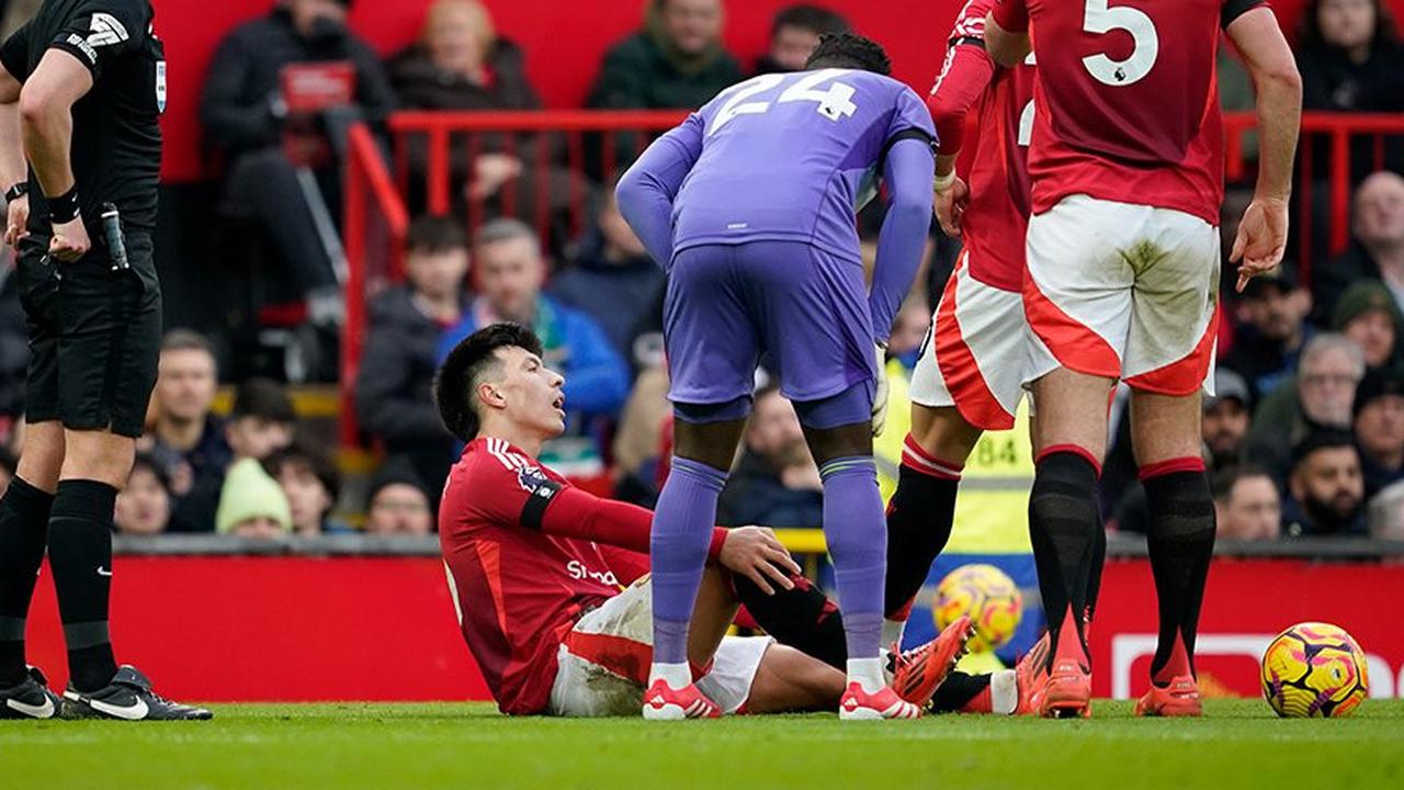 Mikel Arteta Peringatkan Skuad Arsenal: MU Bukan Lawan yang Sepele!