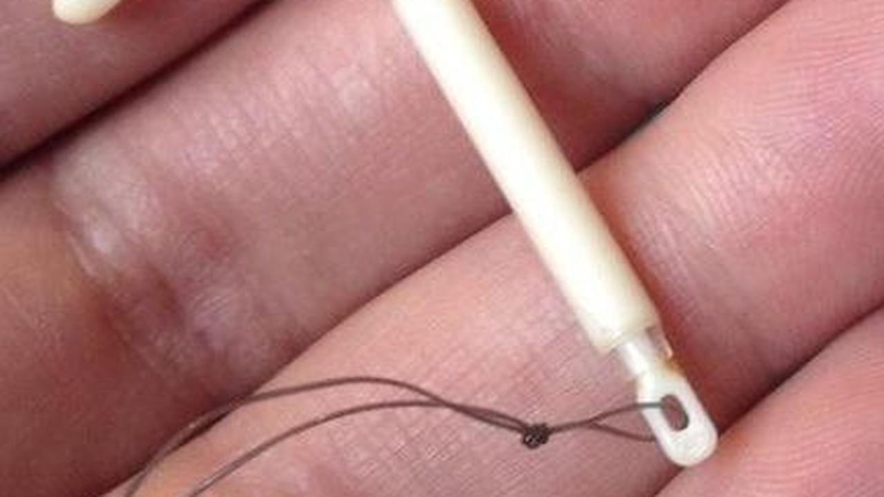 2. KB Spiral (IUD): Hormonal vs. Non-hormonal