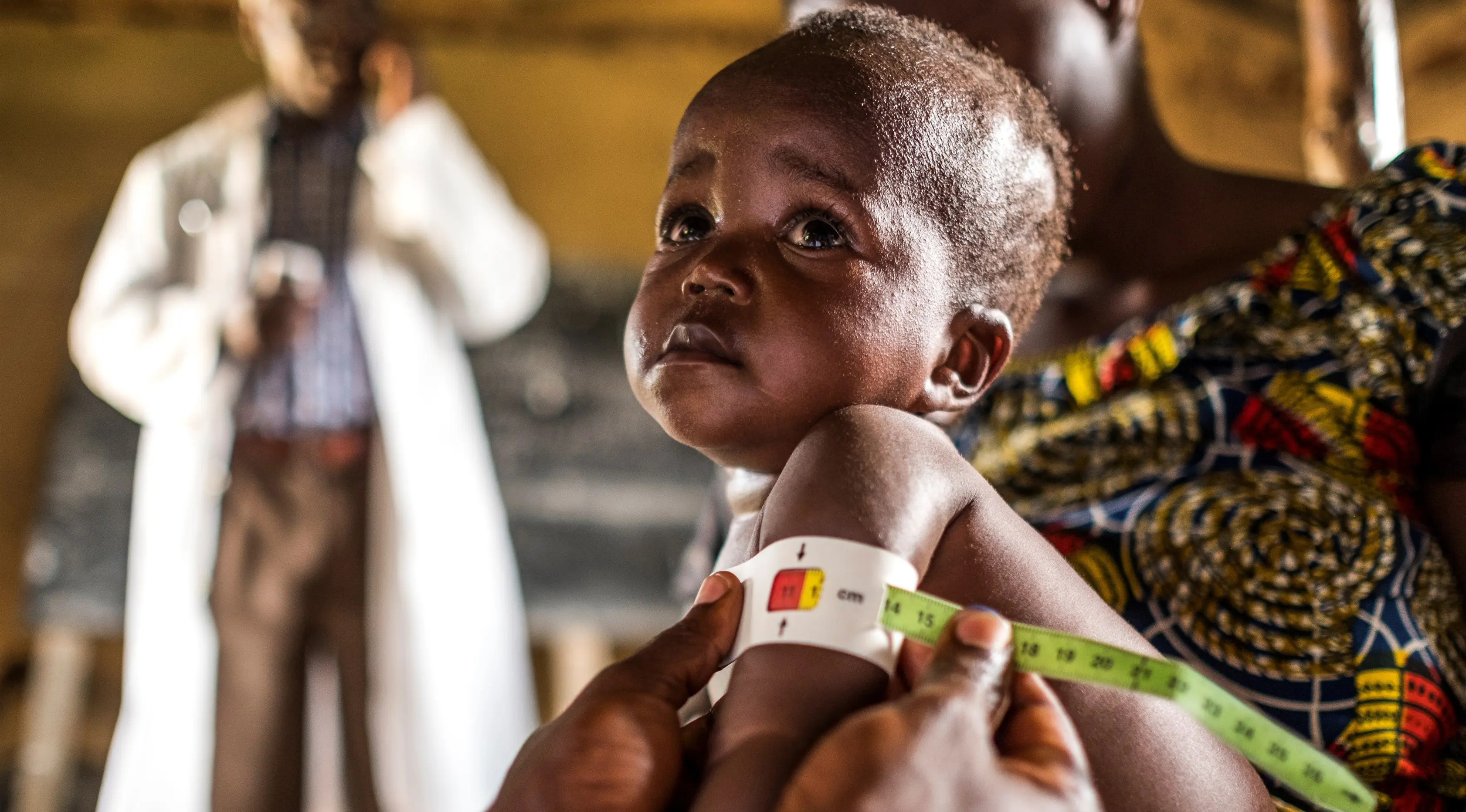 Ekspresi seorang anak saat diperiksa untuk program pencegahan kurang gizi di Pusat kesehatan di Mbau, Republik Demokratik Kongo (15/11). Di negara ini banyak penduduknya menderita kekurangan gizi. (AFP/ Eduardo Soteras)