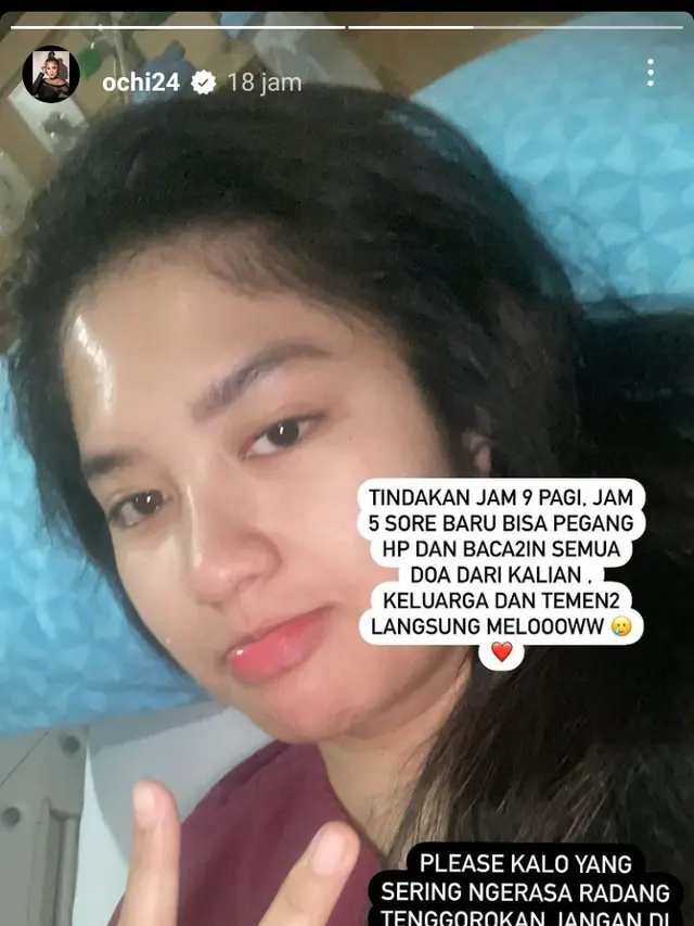 Ochi Rosdiana usai jalani operasi (Foto: Instagram @ochi24)