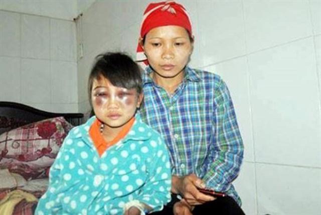 Anak yang dipukul gurunya dengan sang ibu saat berada di rumah sakit | Photo: Copyright asiantown.net