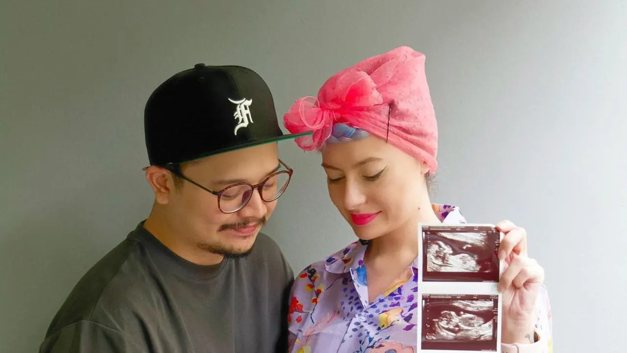 Melahirkan Anak Pertama, Ini 7 Potret Perjalanan Kehamilan Istri Derby Romero