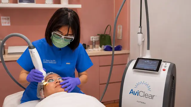 Melawan Jerawat dari Akarnya dengan Teknologi Laser yang Jadi Babak Baru Perawatan Kulit