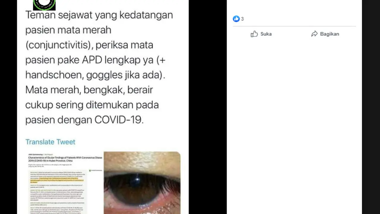 Mata Merah, Bengkak dan Berair Gejala Posif COVID-19? Simak Faktanya