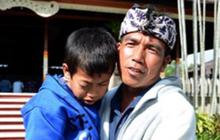 Acara Gubernur Bali dihebohkan kehadiran anak dengan kelainan mata