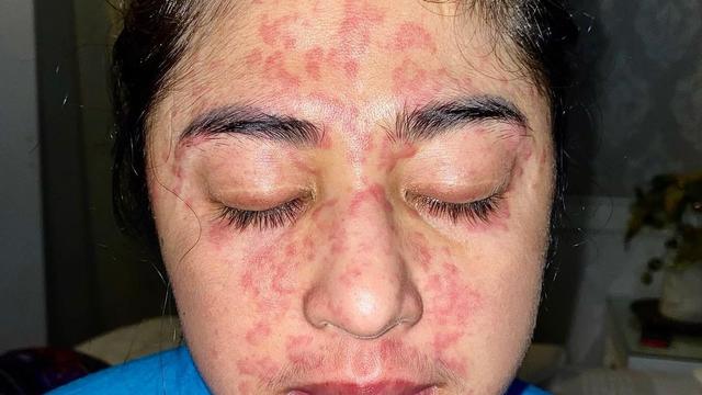 [Fimela] Dewi Perssik