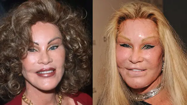 Jocelyn Wildenstein