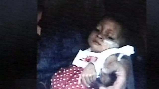 [VIDEO] Bayi Kelainan Hati yang Dipulangkan RSCM Kini Membaik