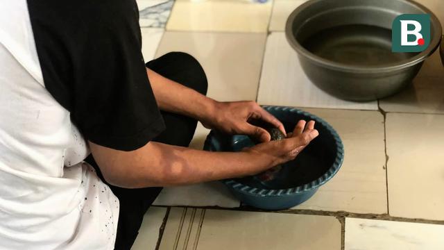 Obati Kusta Sebelum Berujung Disabilitas, Menkes Budi Jelaskan Ciri-cirinya