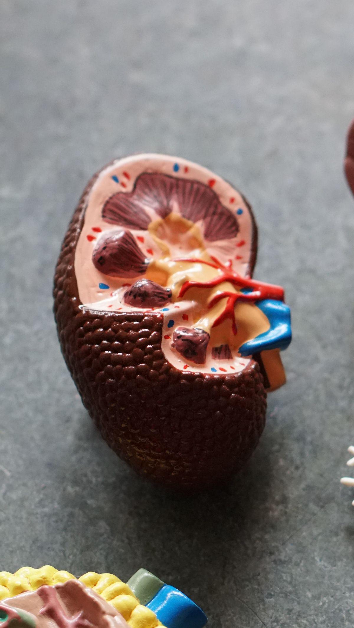 Akibatnya, racun-racun dalam urine dapat menumpuk di ginjal dan menyebabkan kerusakan pada organ tersebut, yang dapat mengakibatkan gagal ginjal.