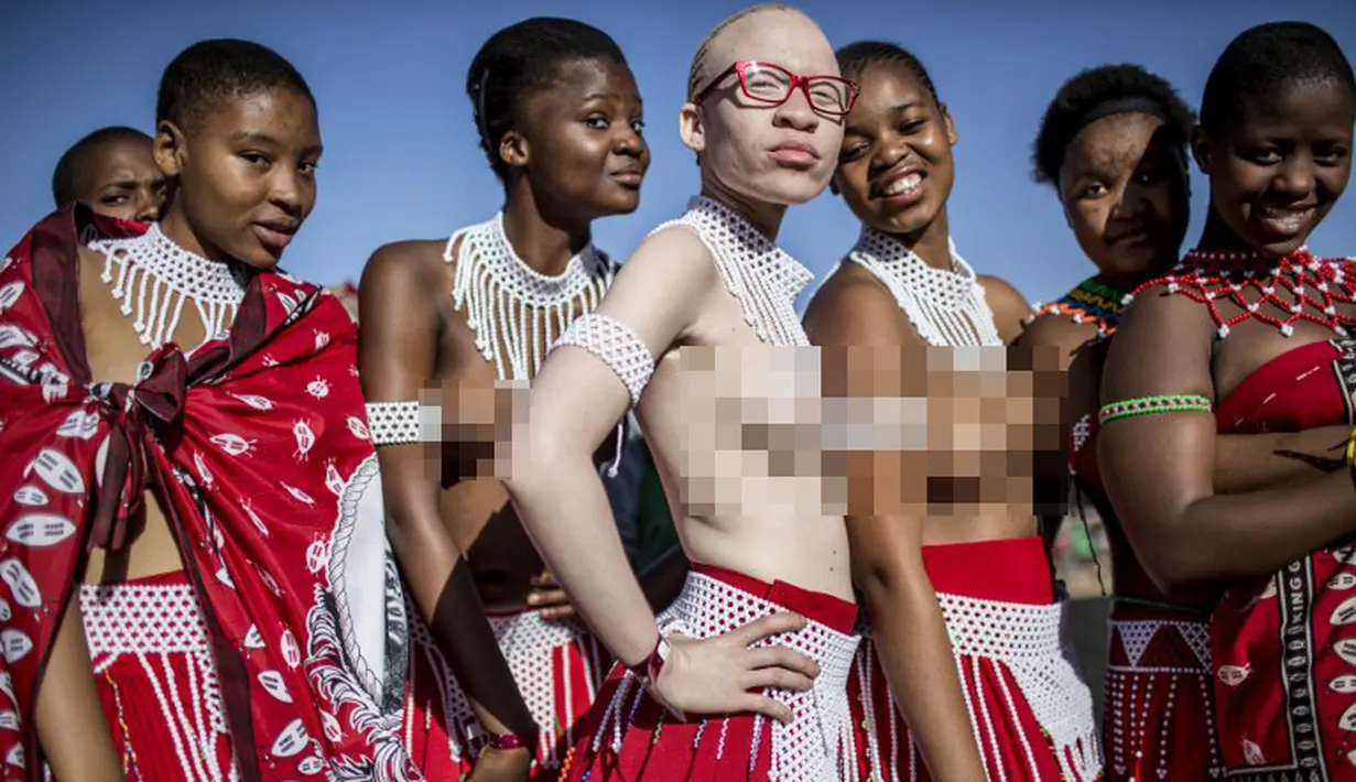 Seorang gadis albino Afrika Selatan berpose dengan gadis lain, telanjang dada dalam upacara Reed Dance, Afsel (5/9/2014) (AFP PHOTO / MARCO LONGARI)