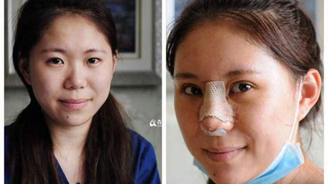 Muak Dengan Makeup Wanita Ini Pilih Operasi Plastik Fashion Beauty Liputan6 Com