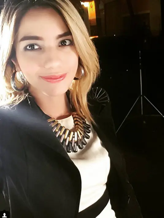 Menurut Erie, manajer Sheila, membenarkan bahwa Sheila dan Vanesha mengalami kecelakaan. Ia mengatakan, Sheila yang berada dalam kondisi sadar namun belum bisa dimintai keterangan secara langsung. (Instagram/itsheilamj)