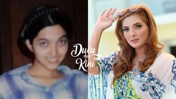 Dulu dan Kini: Transformasi Ashanty Cantiknya Awet Seperti Cewek Arab