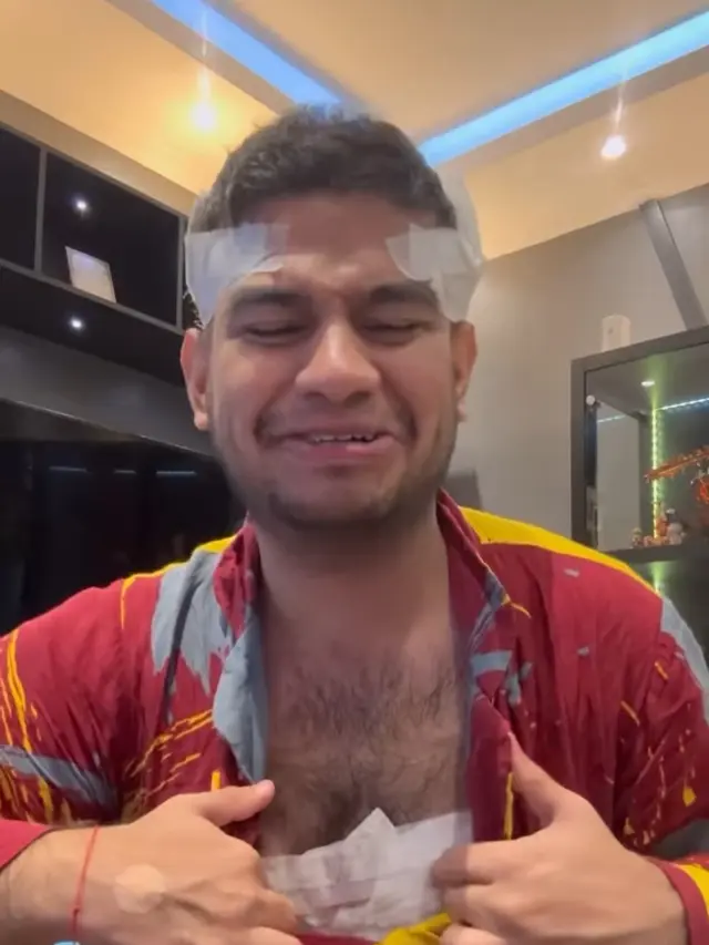 Artis Punya Bulu Dada