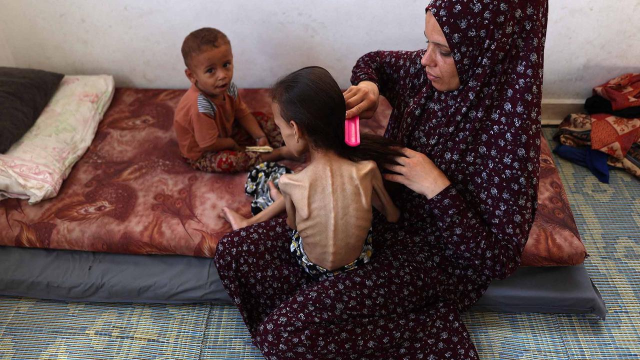 FOTO: Potret Pedih Mariam Anak 9 Tahun, Korban Kelaparan Gaza