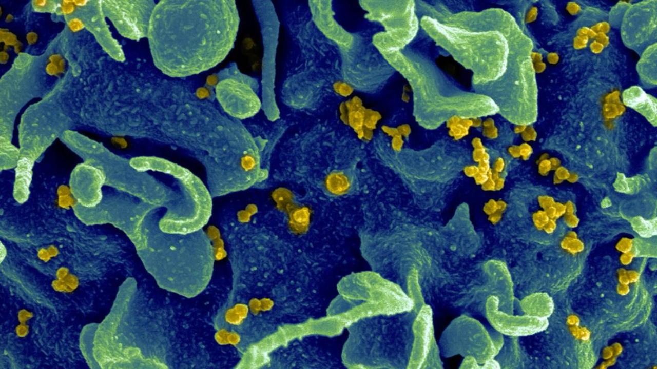 Memahami Siklus Hidup HIV