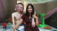 Foto seorang wanita yang berdiri di samping kekasihnya yang terkena kanker, telah membuat hati warganet terenyuh. (Doc: Facebook.com/Atittaya Chumkeaw)