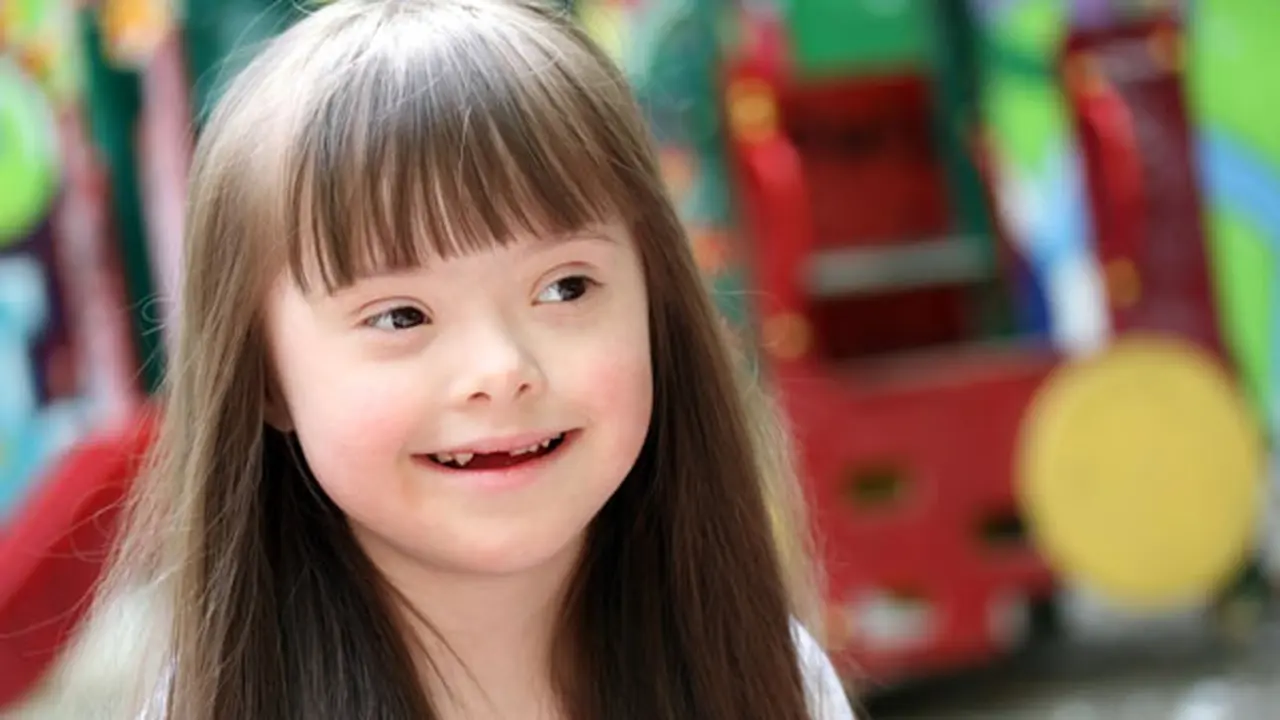 Down Syndrome