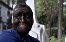 Mengenal Jesus Aceves, manusia serigala dari Meksiko