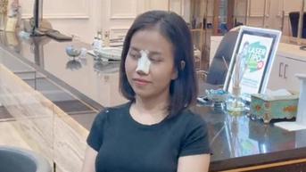 Doddy Sudrajat Hapus Foto Mayang Adik Mendiang Vanessa Angel Usai Operasi Hidung Tak Lama Setelah Diunggah
