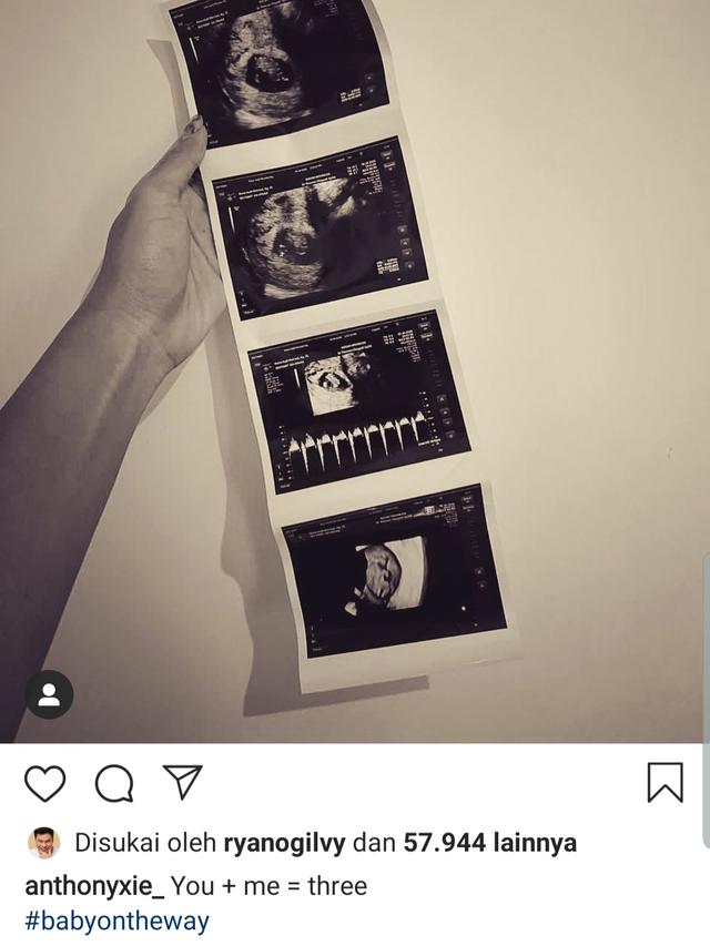 Unggahan Anthony Xie. (Foto: Instagram @anthonyxie_)