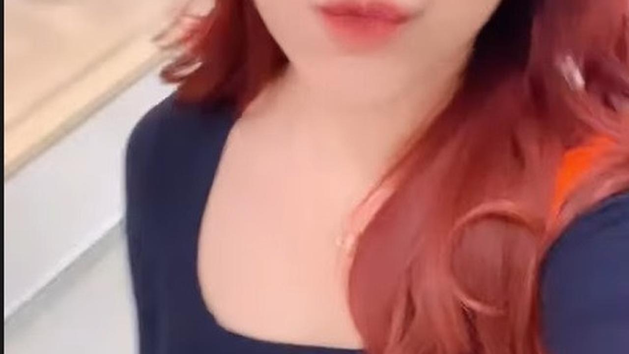 Hasil Operasi Hidung yang Ke dua