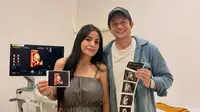 Andrew Andika Siap Sambut Kelahiran Anak Perempuan, Ungkap Alasan Pilih Operasi Caesar