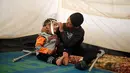 Jasim Abudllah bercanda dengan adiknya di dalam tenda sebuah kamp Debaga, di pinggiran Erbil, Irak (24/11). Meski hidup dengan satu kaki akibat terkena serangan udara, Jasim berusaha hidup seperti bocah normal lainya. (Reuters/Mohammed Salem)