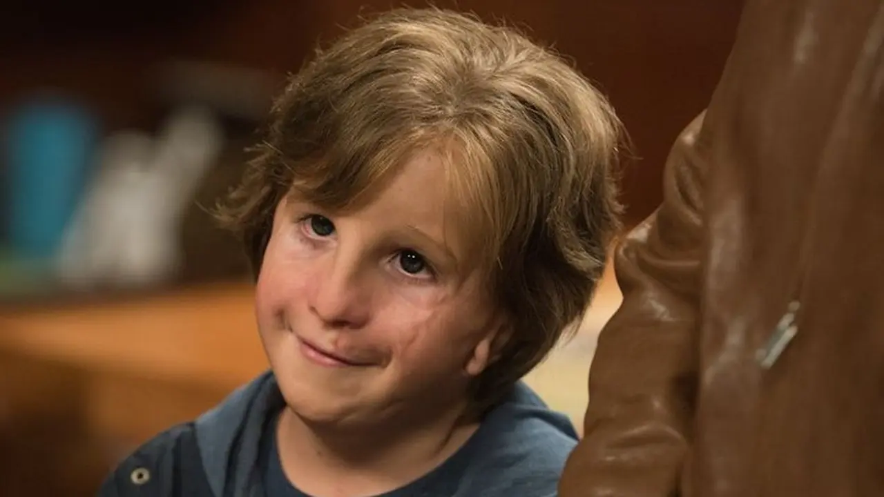 Ilustrasi treacher collins syndrome dalam film wonder.