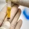 7 Warna Urine dan Artinya yang Perlu Anda Tahu