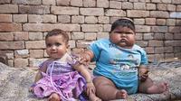 Bayi yang lahir 10 bulan lalu dengan berat 4 kilogram ini, kini seperti anak perempuan berusia enam tahun karena bobotnya yang mencapai 12 