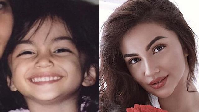 6 Potret Masa Kecil Seleb Cantik Tanah Air, Lucu dan Unyu