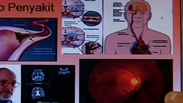 Ternyata Puasa Bisa Mencegah Diabetes