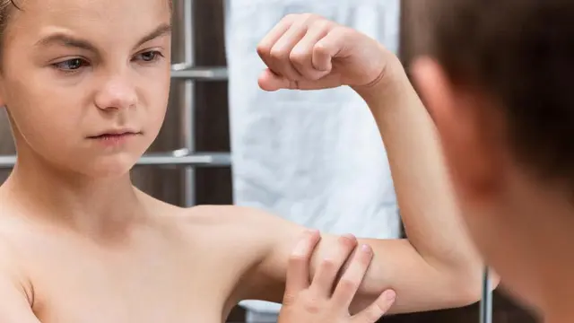 Anak Kurus Belum Tentu Kurang Gizi