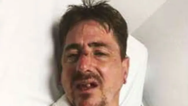Stephen O'Hagan (47) jadi diduga jadi korban kebrutalan mantan petinju Inggris, Ricky Hatton