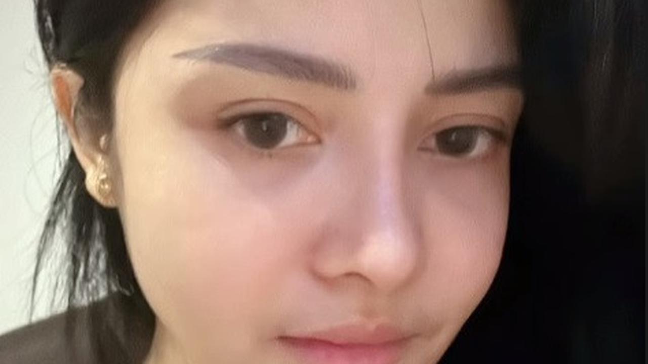 8 Foto Terbaru Mawar AFI Setelah Melakukan Operasi Plastik pada Hidung, yang Kabarnya Mencapai Biaya Lebih dari Rp70 Juta