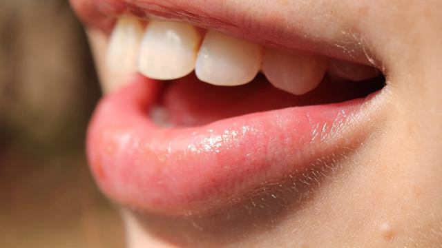 Alasan Mengapa Lebih Baik Tidak Menyikat Gigi Setelah Makan