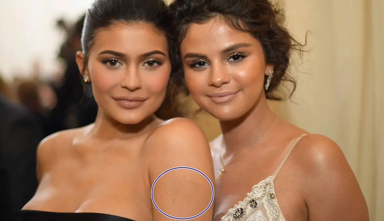 Kylie Jenner memang baik-baik saja. Namun para penggemar bingung dengan plester yang tersembunyi dengan sempurna di lengannya. (E! Online)